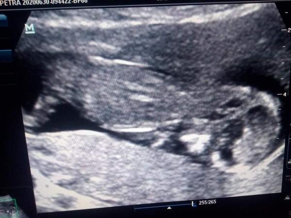 Co myslíte, holka nebo kluk?