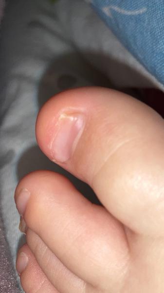 Zkušenosti s doktorem online pro problémy s nehty.