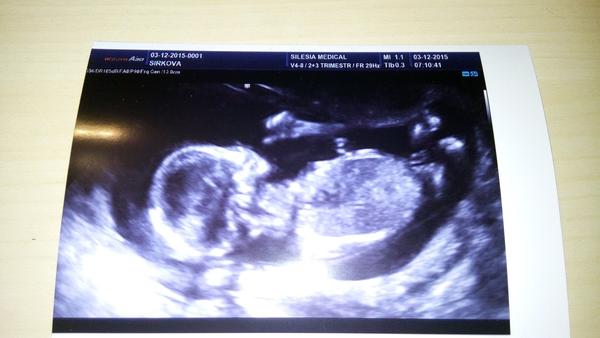 Jméno pro miminko - Samuel, Julie 🙂