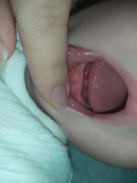 Je to růst zubů u dítěte?