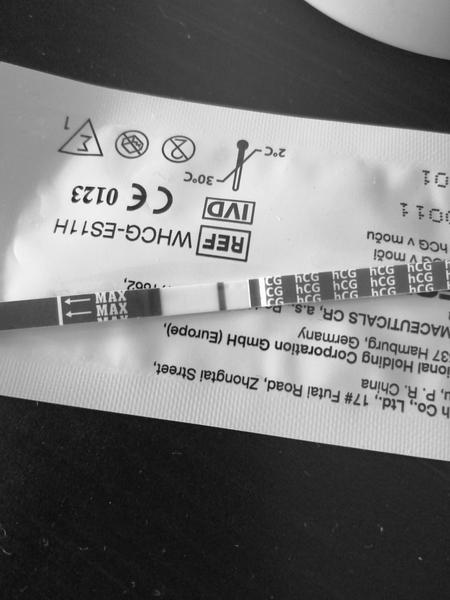 Je něco vidět v TT rentgenu? 