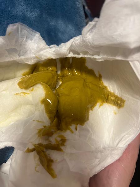 Řídká stolice u miminka na umělé výživě. Je to normální?