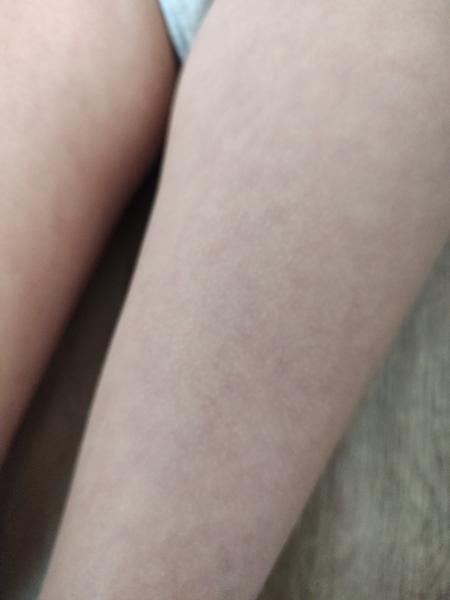 Je normální, když se kůže na nohách mění?