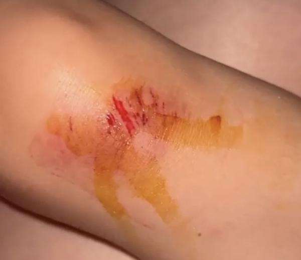 Mám jet s dcerou k lékaři po pádu?