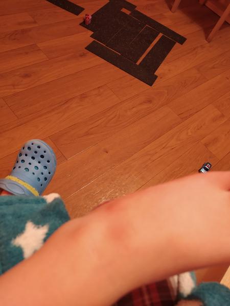 Boule. Co by to mohlo být?