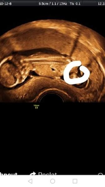 Co myslíte, je to kluk?