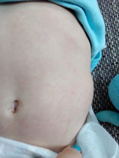 Červené flíčky kolem plíny