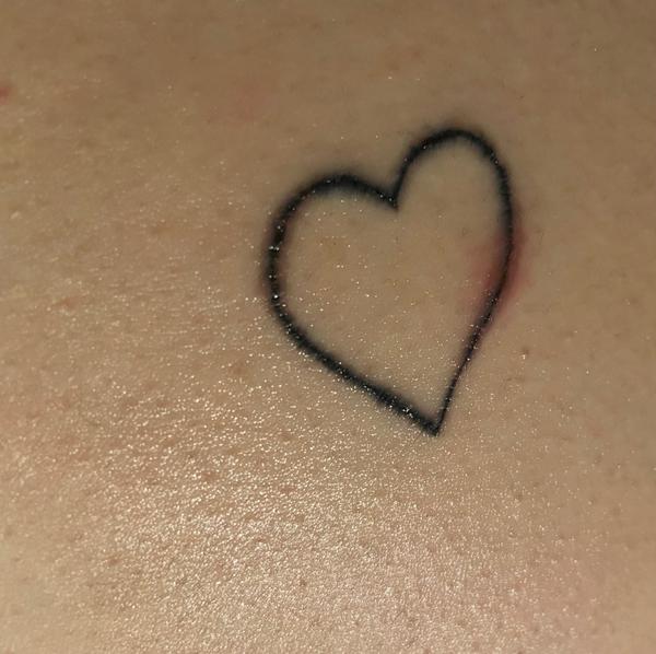 Infekce po tetování. Jak rozpoznat a co dělat?