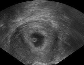 Těhotenství 8+2. Podle utz vypadá mladší - je to normální?