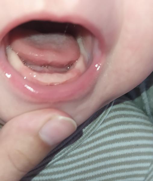 Je normální, že dítěti v 4 měsících rostou špičáky?