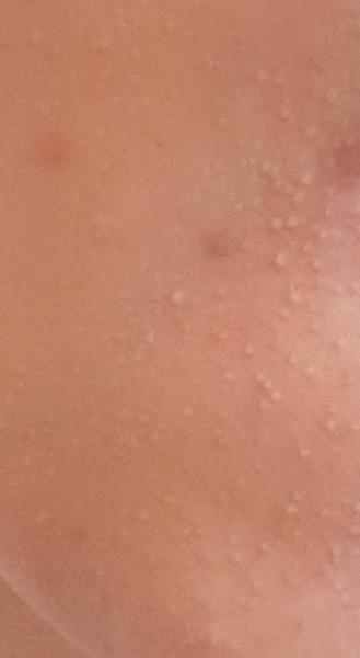 Pleť. Nevíte, co by to mohlo být?