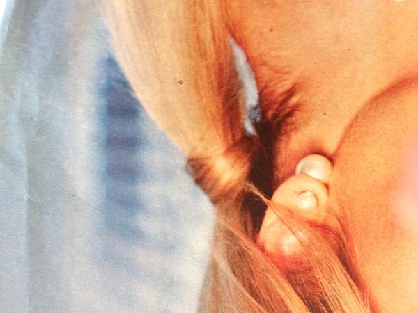 Cop utažený pramenem vlasů, jak postupovat?