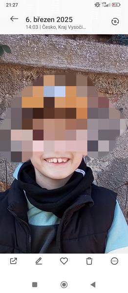 Křivé zoubky u dětí. Může růst dalších zubů pomoci?