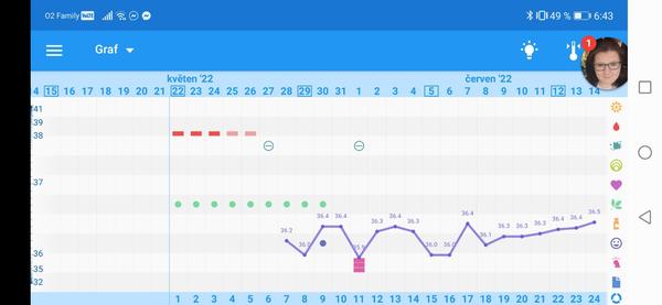 Co znamená váš bazální teplotní graf?