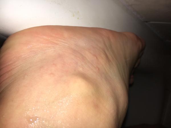 Vyrážka? Poradíte, prosím?