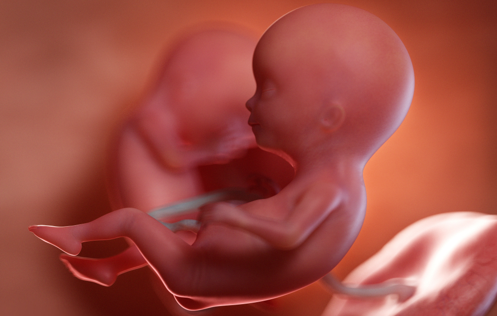 Transfúzní syndrom dvojčat – TTTS