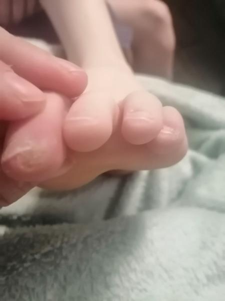 Něco na prstu. Co by to mohlo být?