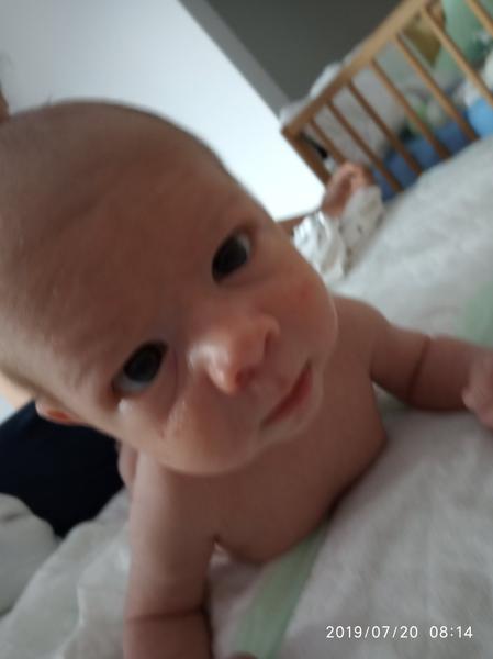 Vyrážka v obličeji, za ušima a v hlavě u novorozence. Čím mazat?