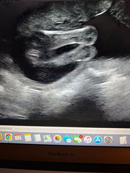 Holčička nebo chlapeček? Co vidíte na obrázku?