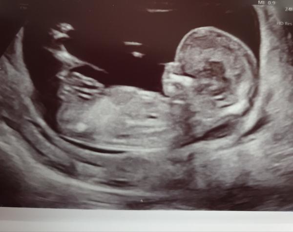 Pohlaví miminka. Poznal byste?