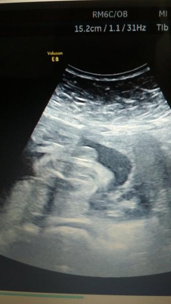 Holky, co vidíte? Kluk nebo holka?