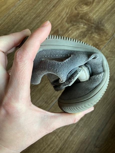 Barefoot sandálky, protetika,24