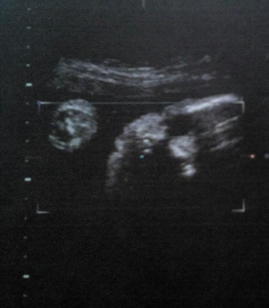 Tak co myslíte? Kluk nebo holka?