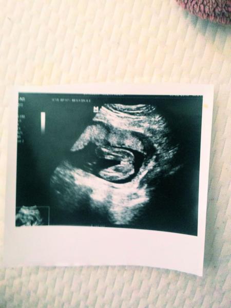 Holčička nebo kluk?