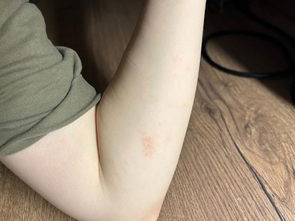 Nevíte, jak řešit kožní problémy po porodu?