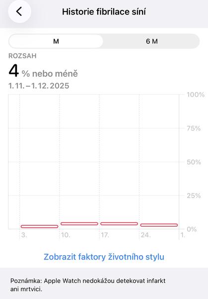 Apple Watch upozornění. Můžu mít fibrilaci síní?