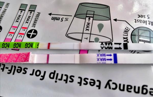 Co znamená ryska? Diskuse a zkušenosti