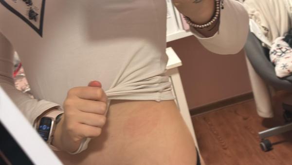 Červený flek se zvětšuje. Jak zjistit příčinu?