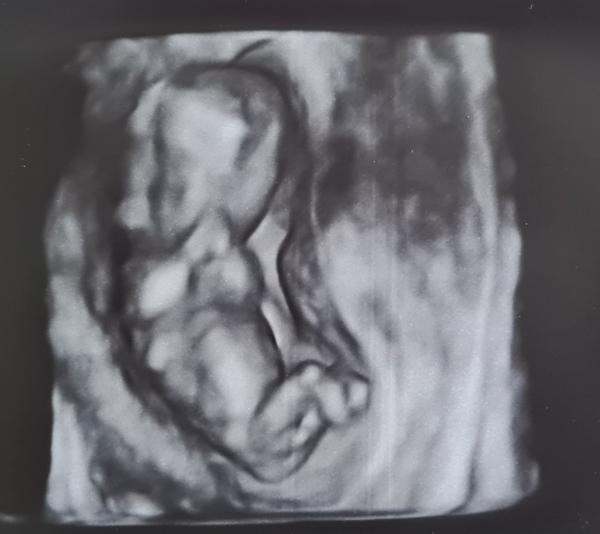 Chlapeček nebo holčička?