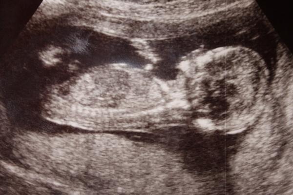 Co tipujete za pohlaví?