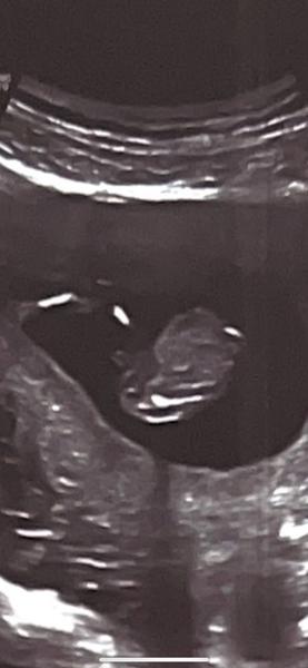 Tipnete si pohlaví z obrázku? Holka nebo kluk?