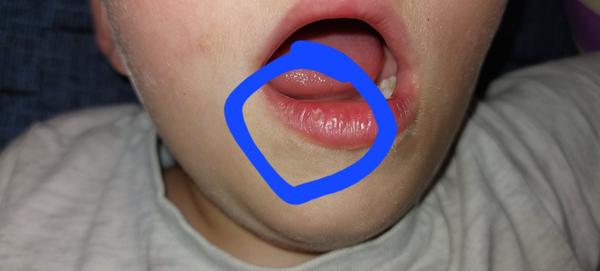 Jak poznat rozdíl mezi oparem a suchou kůží?