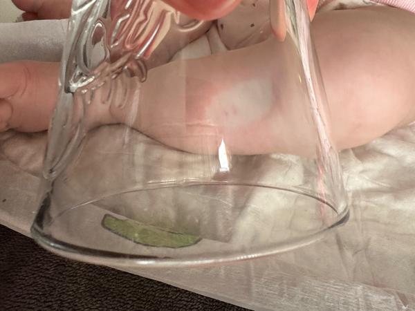 Co znamenají tečky na noze miminka?