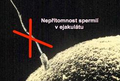 Nepřítomnost spermií v ejakulátu Nepřítomnost spermií v ejakulátu
