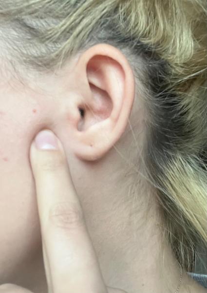 Bolest v ústech po vrtání zubu. Je to uzlinka?