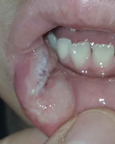 Máte zkušenosti s trháním stoličky u dítěte?