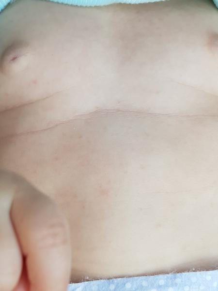 Foto - je to vyrážka nebo potničky?