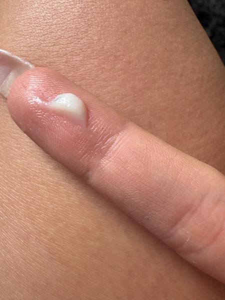 Co znamená mléčný výtok při užívání Duphastonu?