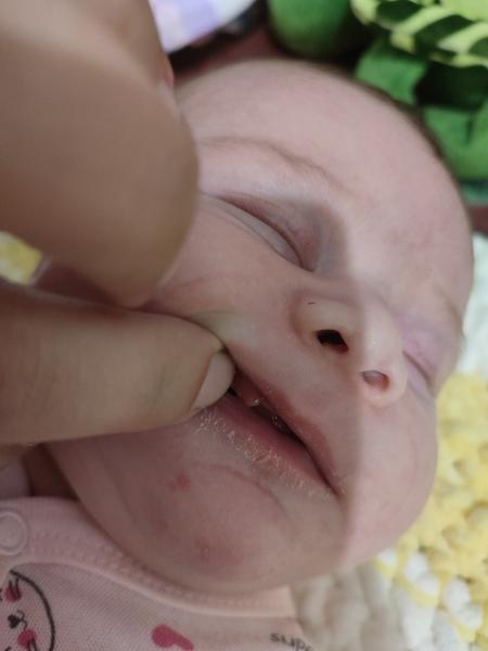 Může mít pětitýdenní dítě zoubky?