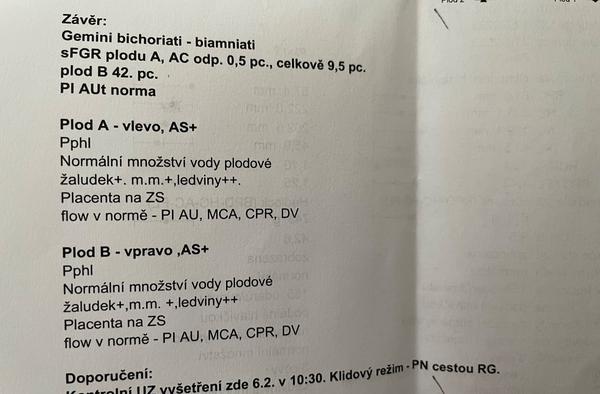 Dvojčata - velikost bříška. Proč tomu tak je? Mohu to nějak ovlivnit?