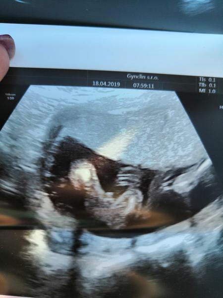 Pohlaví, co myslíte? Je to chlapeček?