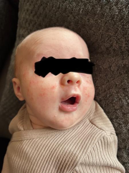 Mohlo by se jednat o seboreu?