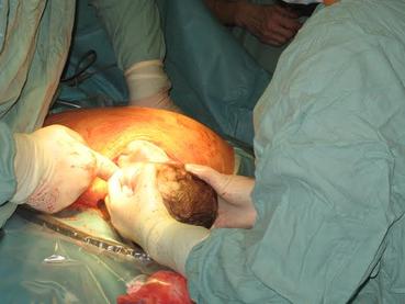 Porod dítěte Porod dítěte