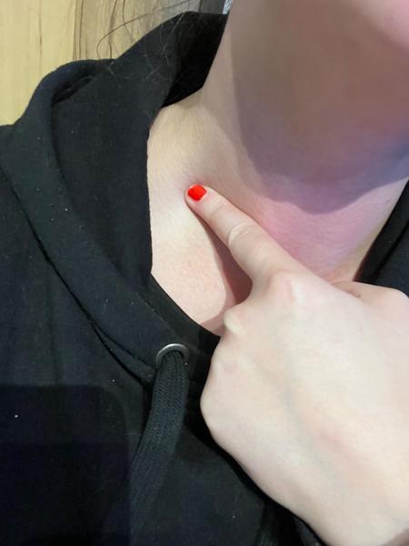 Bulka na krku. Je plná tekutiny?