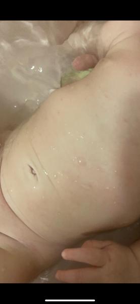 Vyrážka. Je možná alergická rekace na bio dětský čaj?