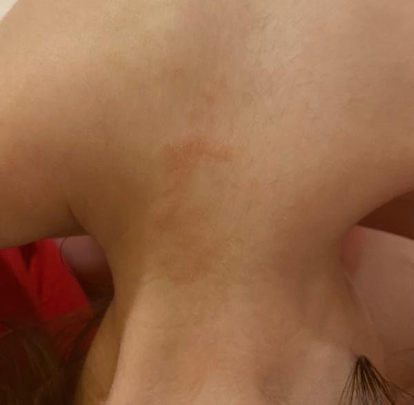 Je to atopický ekzém, nebo něco jiného? Zkušenosti rodičů